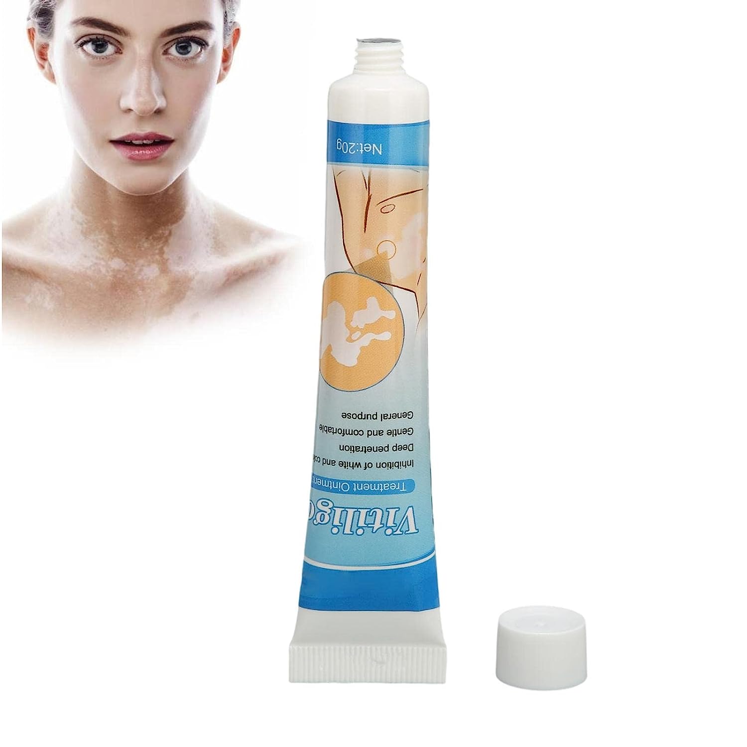Vitiligo Cream, Vitiligo Care Cream for Skin Vitiligo, [...]