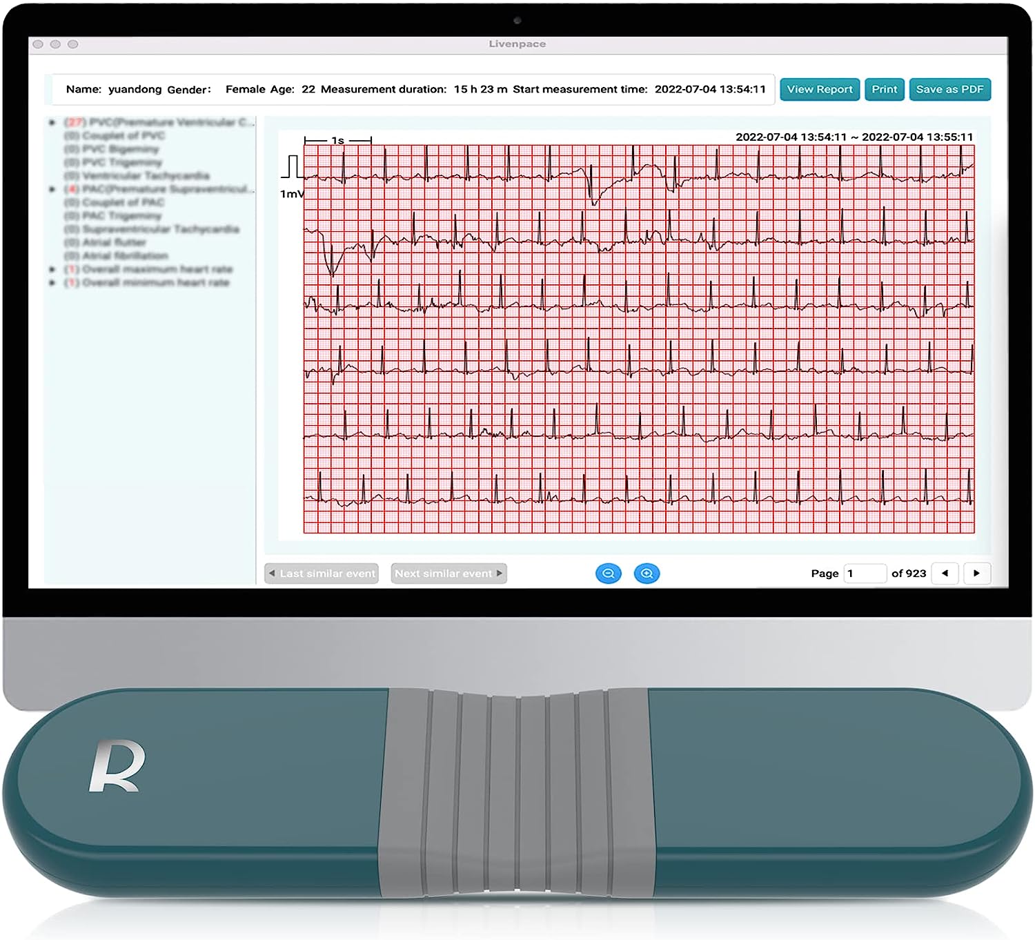 Livenpace AI HR Monitor, 24 Hours Chest Lead Device [...]